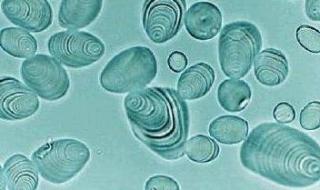 直链淀粉和支链淀粉